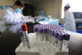 В России зафиксирована первая смерть от «гонконгского гриппа»